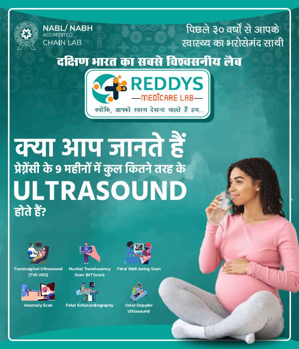 Banner-Homepage-Desktop-4_700x600